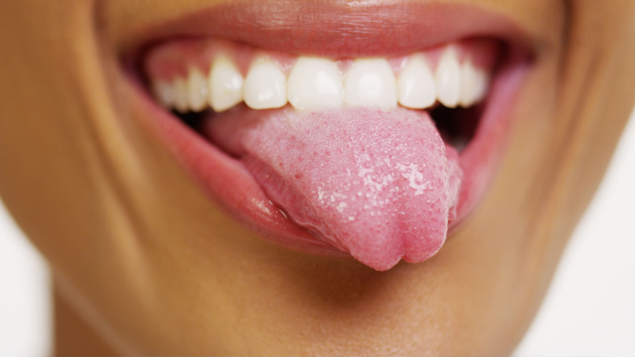 The Truth About Tongue Scrapers - Dentist in SLO, CA | SLO Smiles ...